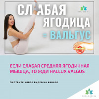 Если слабая СРЕДНЯЯ ЯГОДИЧНАЯ мышца, то жди Hallux Valgus